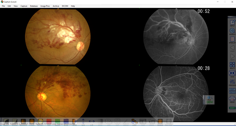 Multiple image display